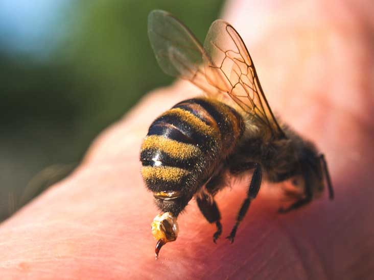 Arı Sokmasına İyi Gelen Doğal Yöntemler