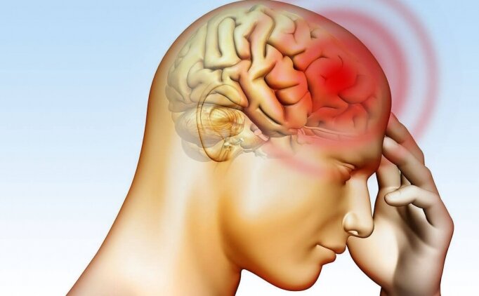 Beyin Kanaması Tedavisi Nedir?