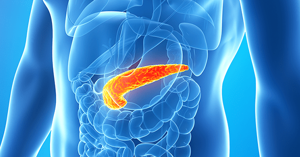 Pankreas kanseri neden olur? Belirtileri ve tedavisi